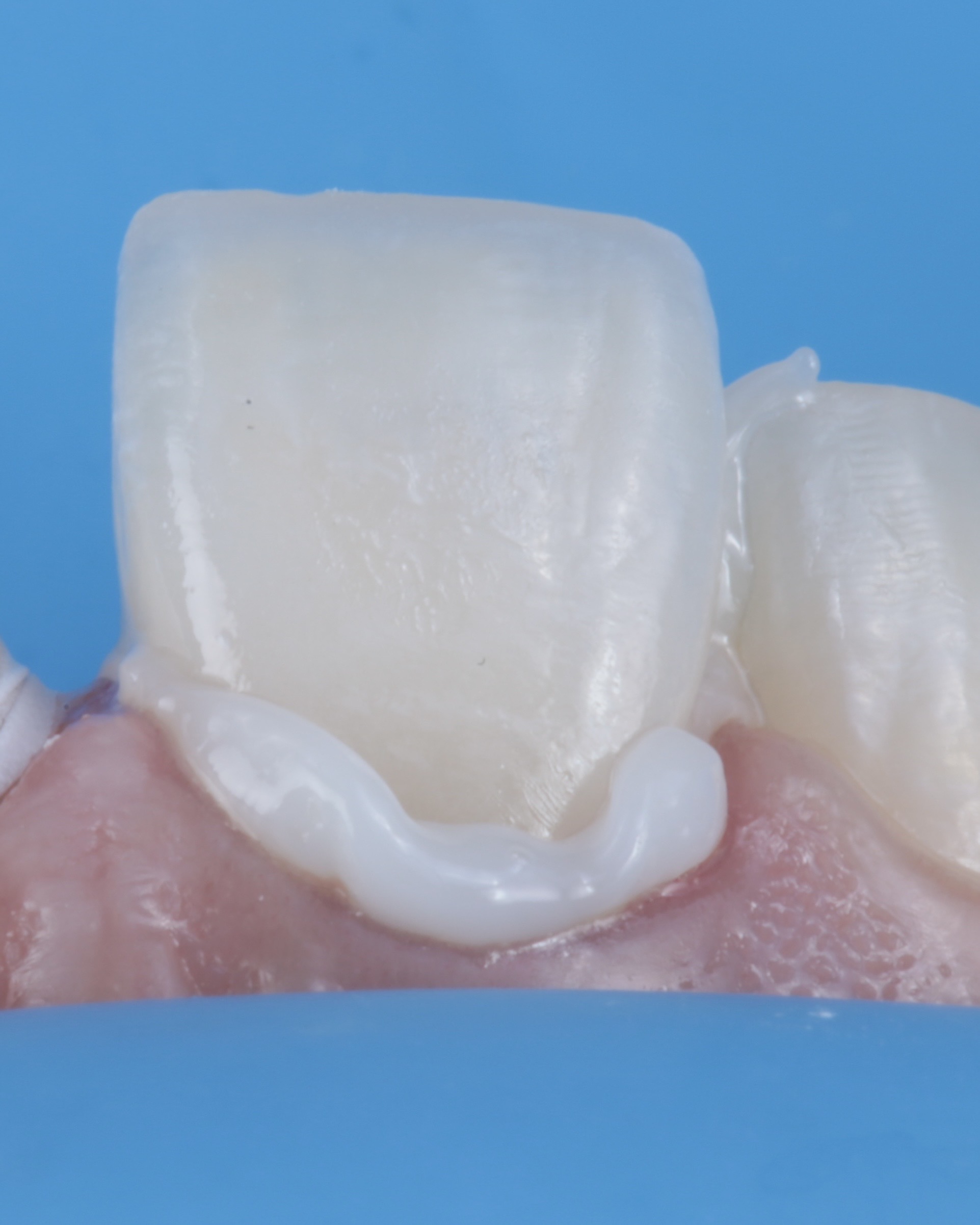 Detalle del sustrato dentario